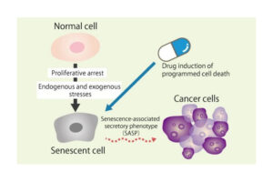 A drug could induce programmed cell death in senescent cells expressing SASP factors.