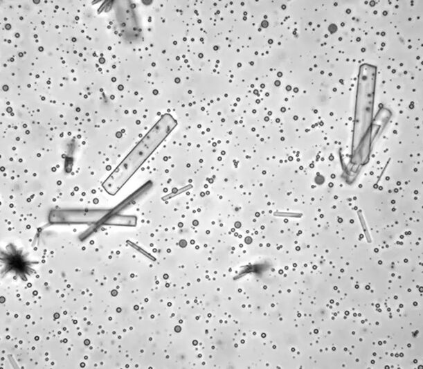 Calcium tartrate crystals can coexist with tartrate-containing polyester microdroplets, suggesting the potential for dynamic phase transitions of tartrates or tartrate-containing molecules on early Earth. Credit: Chen Chen