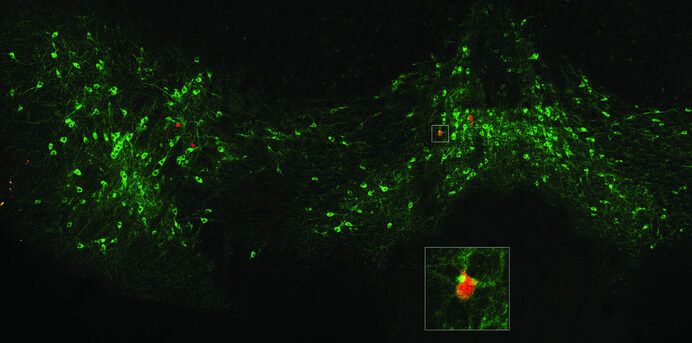 An edited version of a figure from the research shows the ventral tegmental area, highlighting dopamine-associated neurons in green and one that connects to the posterior amygdala (magnified in inset) in red Credit: Tonegawa Lab/MIT Picower Institute