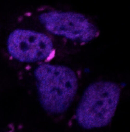 Example of protein aggregates within a cell. Credit: IIT-Istituto Italiano di Tecnologia