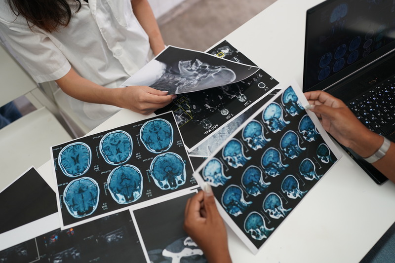 Group of doctors looking at X-ray on medical conference, discussing issues