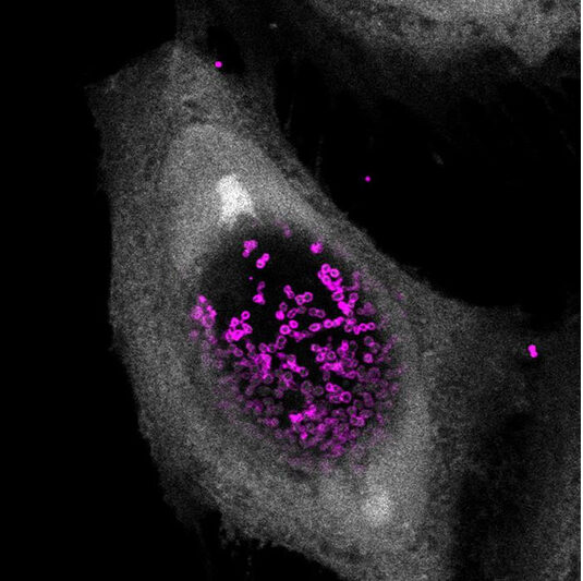 Human cell infected with Chlamydia